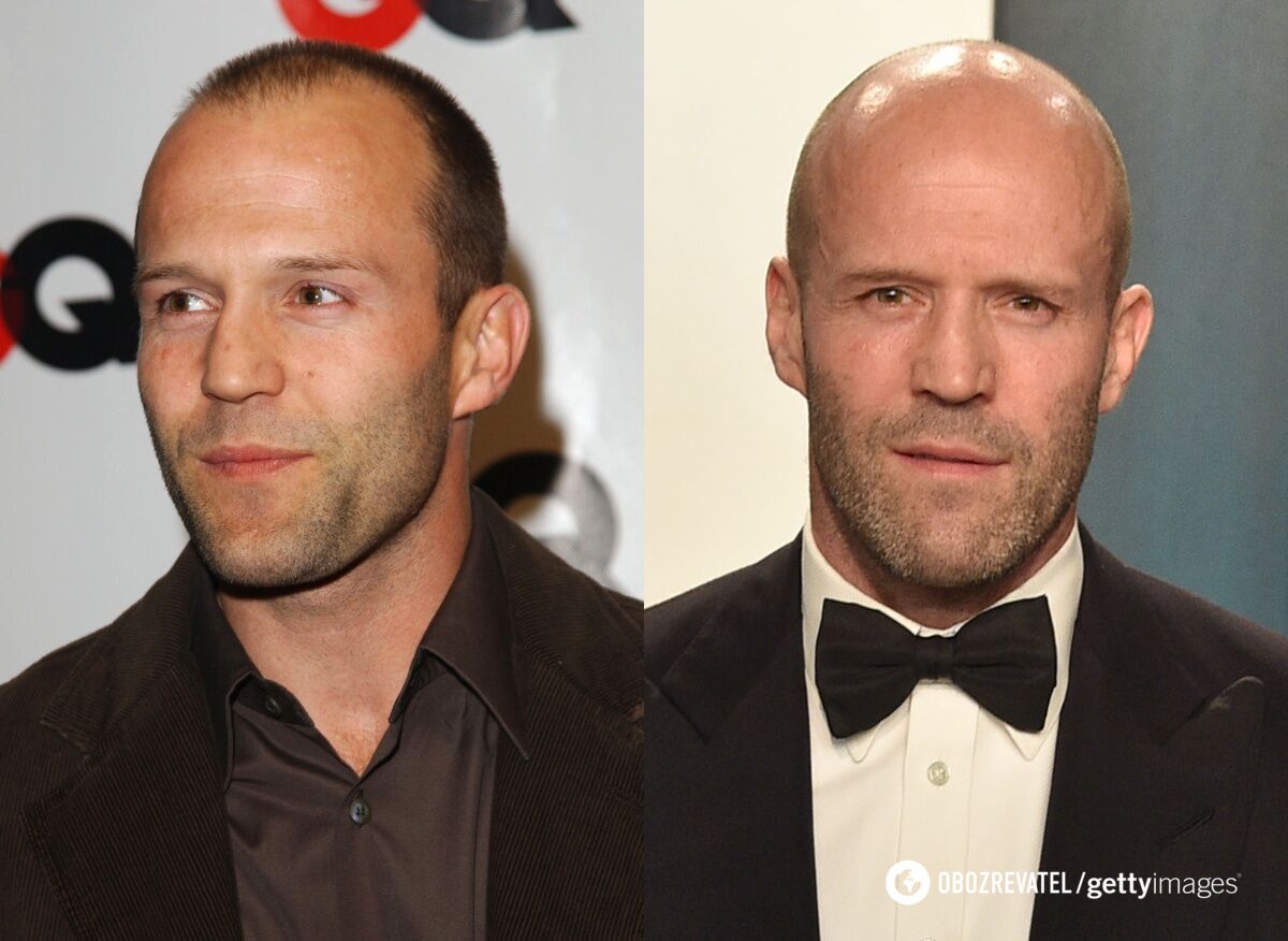 What Dwayne Johnson, Jason Statham and other bald celebrities looked like when they had hair. Photo