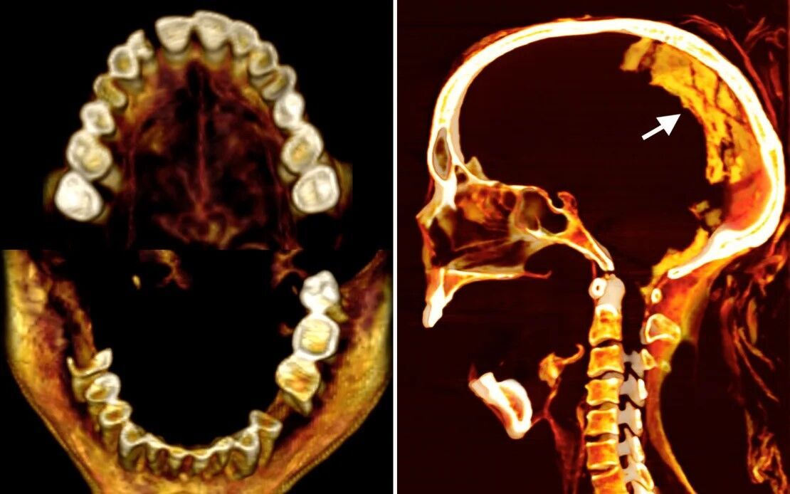 The screaming woman. Scientists have revealed new details of the life and death of the most mysterious Egyptian mummy