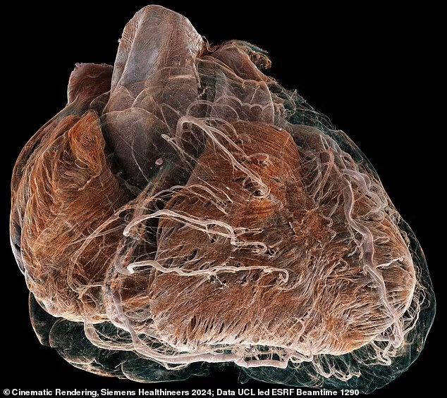 What the human heart looks like from the inside: scientists have shown the difference between a healthy and a sick organ. Impressive video