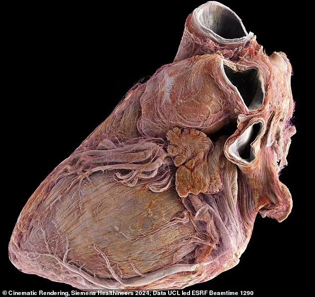 What the human heart looks like from the inside: scientists have shown the difference between a healthy and a sick organ. Impressive video