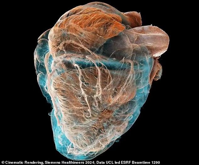 What the human heart looks like from the inside: scientists have shown the difference between a healthy and a sick organ. Impressive video