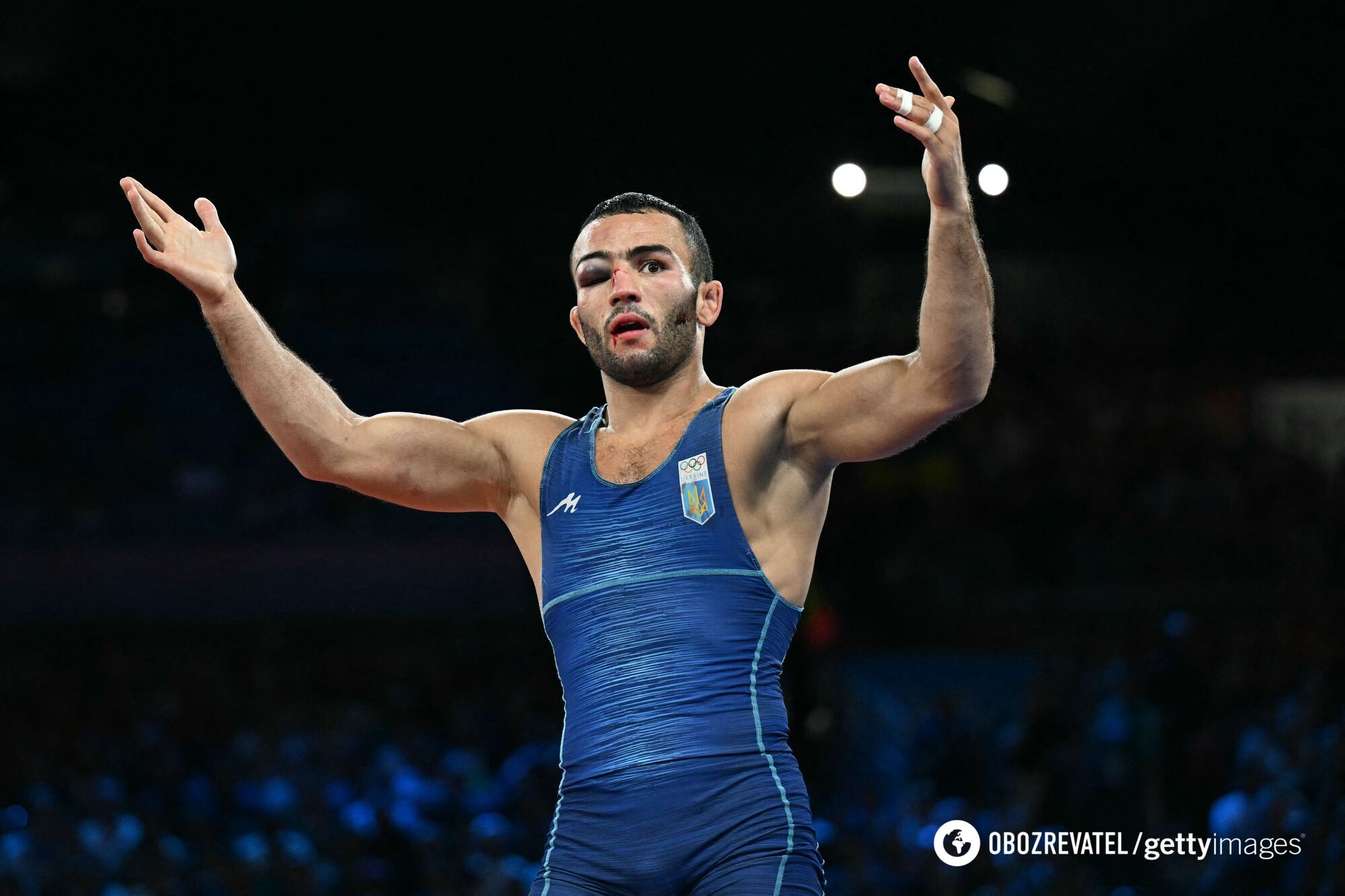 Ukrainian wrestler will be ''repaired'' by doctors before the final of the 2024 Olympics