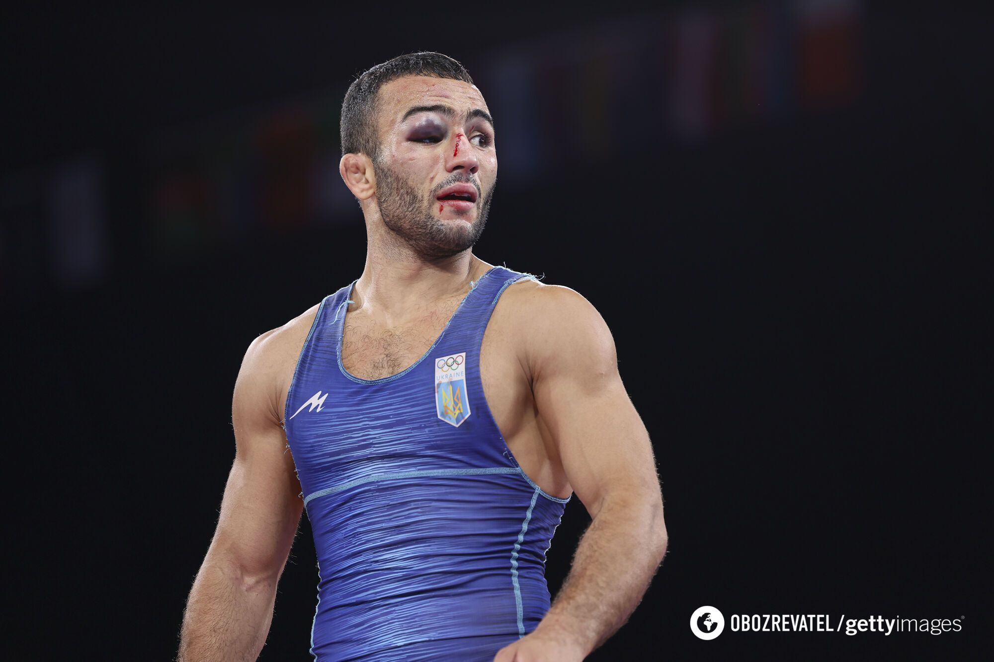 Ukrainian wrestler will be ''repaired'' by doctors before the final of the 2024 Olympics