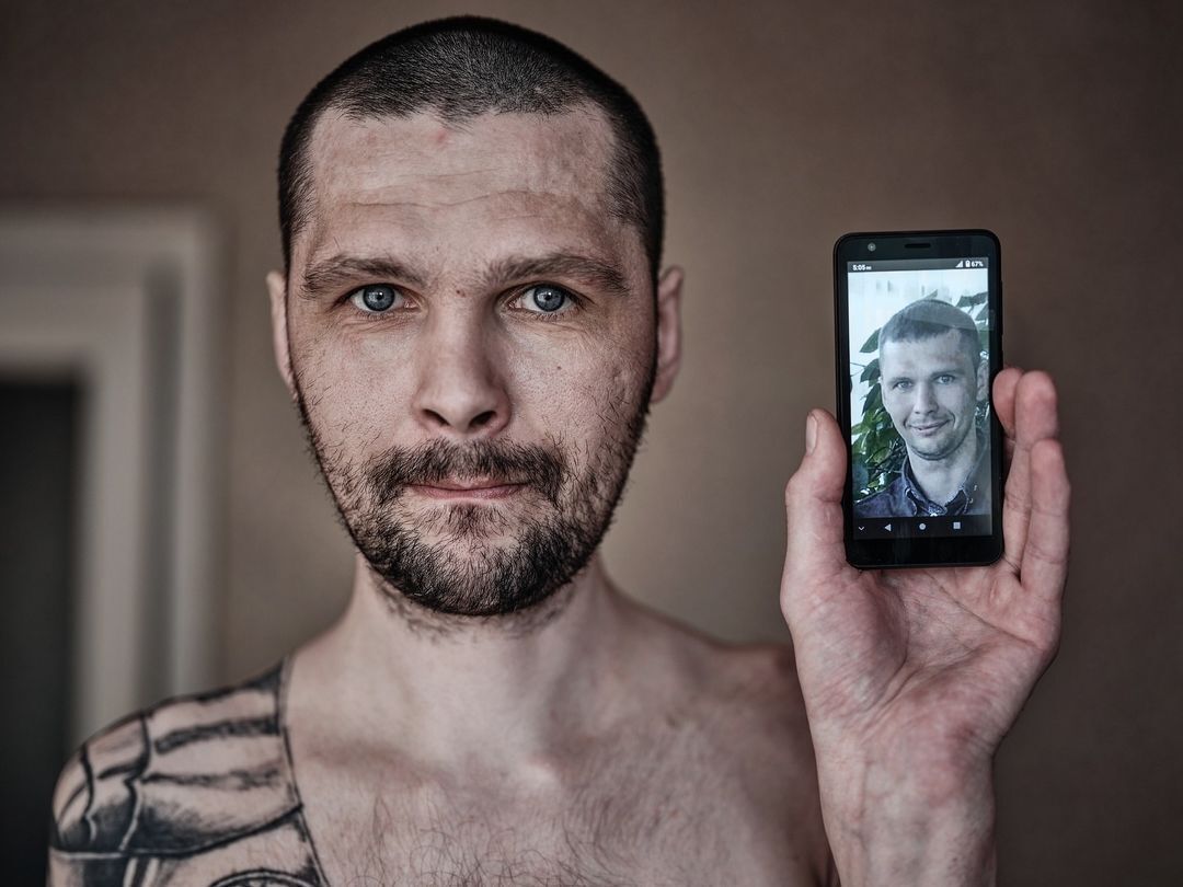 ''Eyes that have seen hell'': the network was impressed by photos of Ukrainian soldiers who returned from Russian captivity