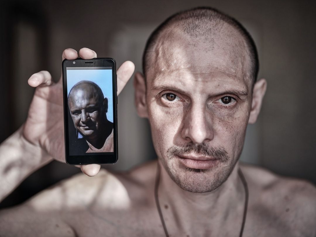 ''Eyes that have seen hell'': the network was impressed by photos of Ukrainian soldiers who returned from Russian captivity