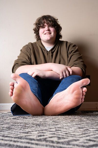 A 16-year-old teenager with giant feet and hands set two Guinness World Records at once. Photo.