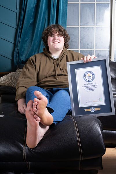 A 16-year-old teenager with giant feet and hands set two Guinness World Records at once. Photo.