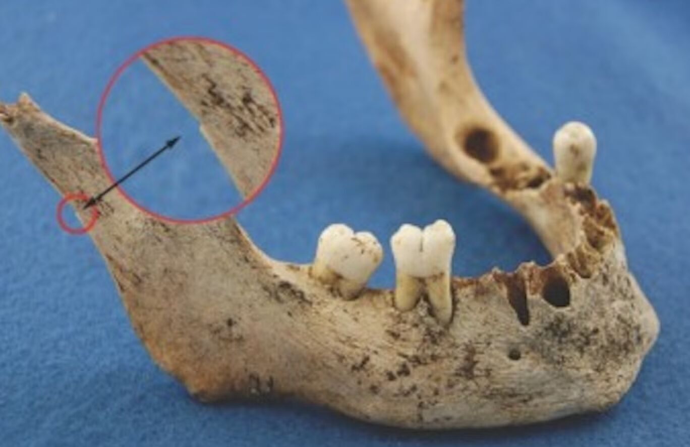 Cannibalism is proven: scientists have made a shocking discovery about Franklin's 1845 expedition. Photo