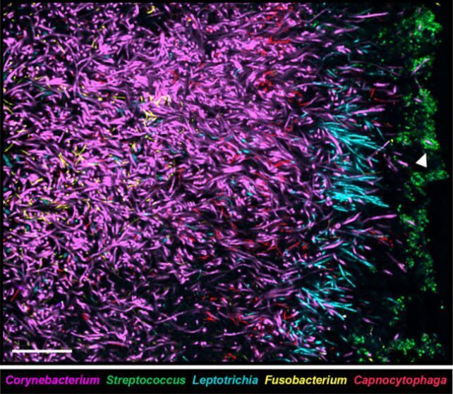 Imagine a large, dense tree. Scientists explained how bacteria multiply in the mouth