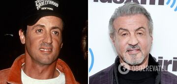 Od Sylvestra Stallone'a do Mickeya Rourke'a: 5 gwiazd, które przeszły operacje plastyczne. Zdjęcie
