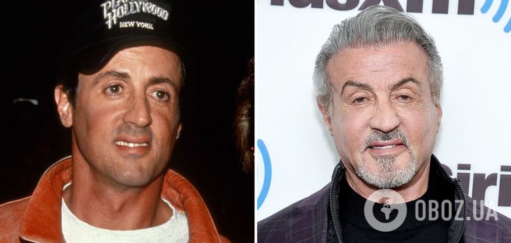 Od Sylvestra Stallone'a do Mickeya Rourke'a: 5 gwiazd, które przeszły operacje plastyczne. Zdjęcie