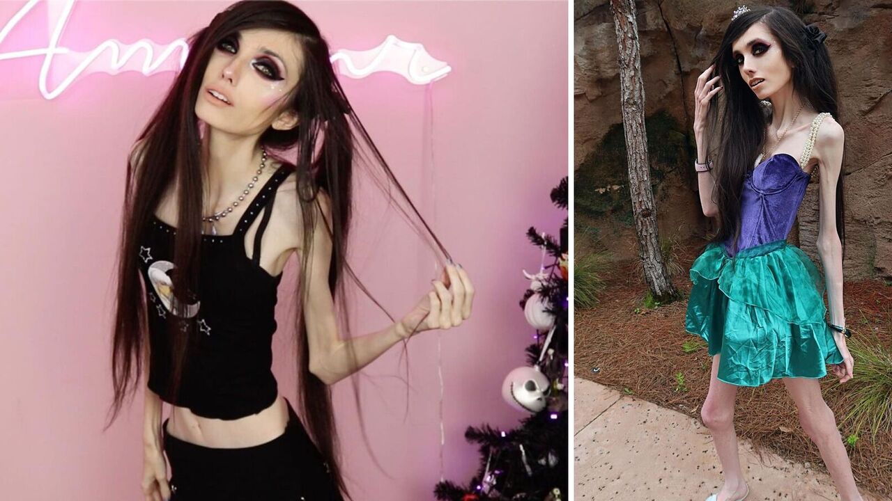 Anorexic TikTok star confuses fans with new videos: what a 29-year-old girl looks like