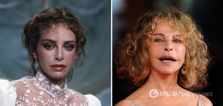 Clearly too much: 5 stars who disfigured themselves with plastic surgery
