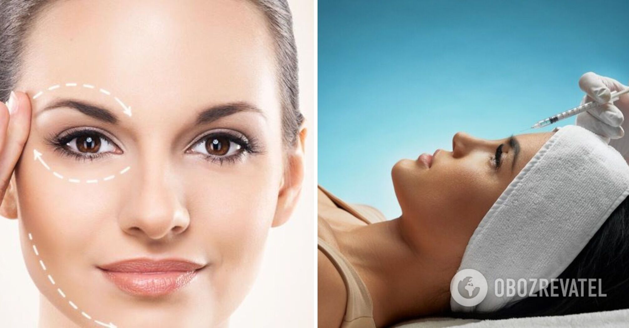 Four myths about Botox injections: what doctors don't tell you