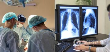 Trwał 16 godzin: we Lwowie przeprowadzono wyjątkowy przeszczep płuc od pośmiertnego dawcy