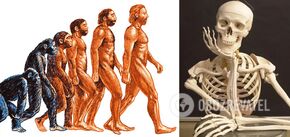 What would happen to the body if people had no bones: scientists stunned by conclusion