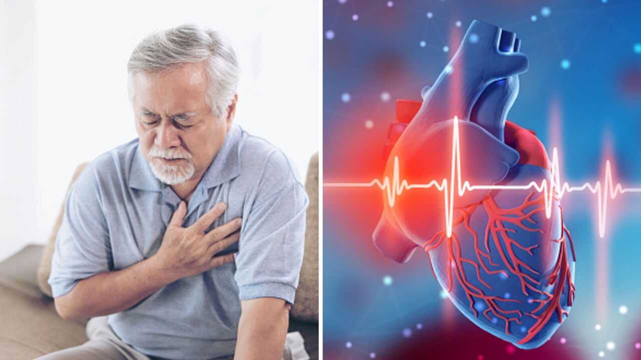 A doctor told us what leads to a heart attack