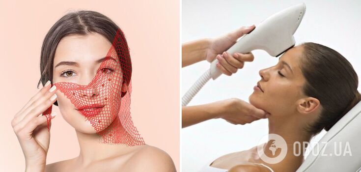 Can dilated blood vessels be removed permanently and what to do to prevent them from reappearing