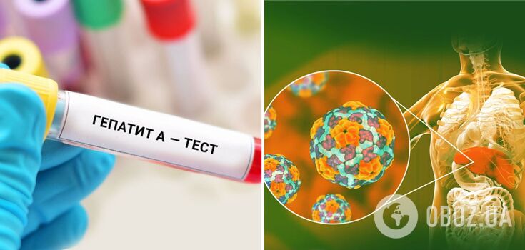 The first case of Hepatitis A has been recorded in the Ternopil region: how to protect yourself