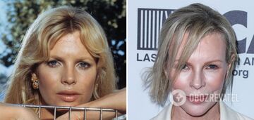 Alec Baldwin's ex-wife surprised fans with an "unrecognizable" face after botched plastic surgery. Photo