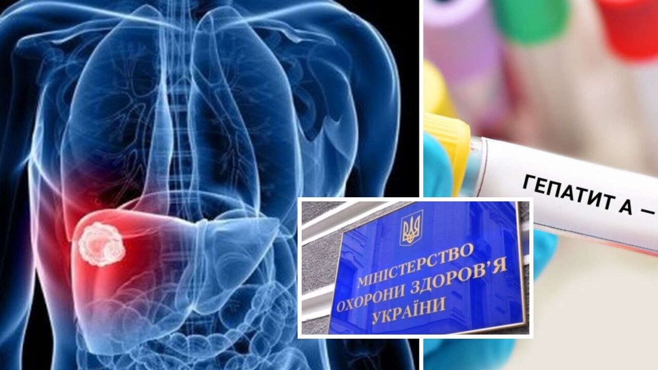 "Fake and a part of the enemy's information warfare": the Ministry of Health of Ukraine has debunked rumors about declaring a quarantine in Ukraine due to a hepatitis A outbreak