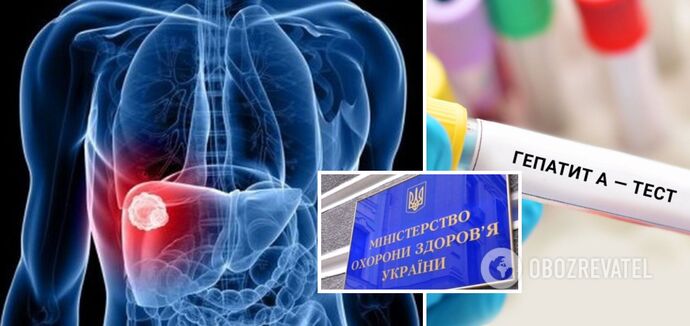 "Fałszywe i część wojny informacyjnej wroga": Ministerstwo Zdrowia Ukrainy zdementowało pogłoski o ogłoszeniu kwarantanny na Ukrainie z powodu epidemii wirusowego zapalenia wątroby typu A