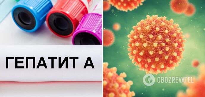 Hepatitis A has already been recorded in five regions of Ukraine: how to protect yourself
