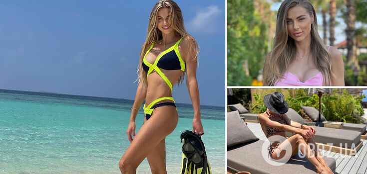 Wife of Ukrainian national football team player got unsuccessful lip augmentation: she showed the consequences