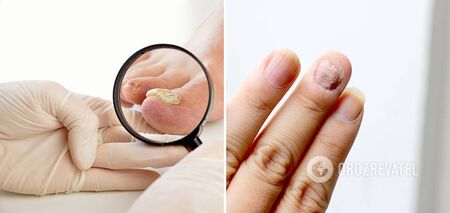 Eksperci mówią, co paznokcie mogą powiedzieć