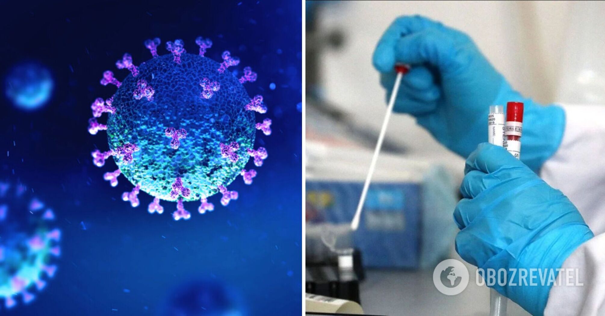 Pierwszy przypadek koronawirusa Pirola na Ukrainie: jak rozpoznać objawy