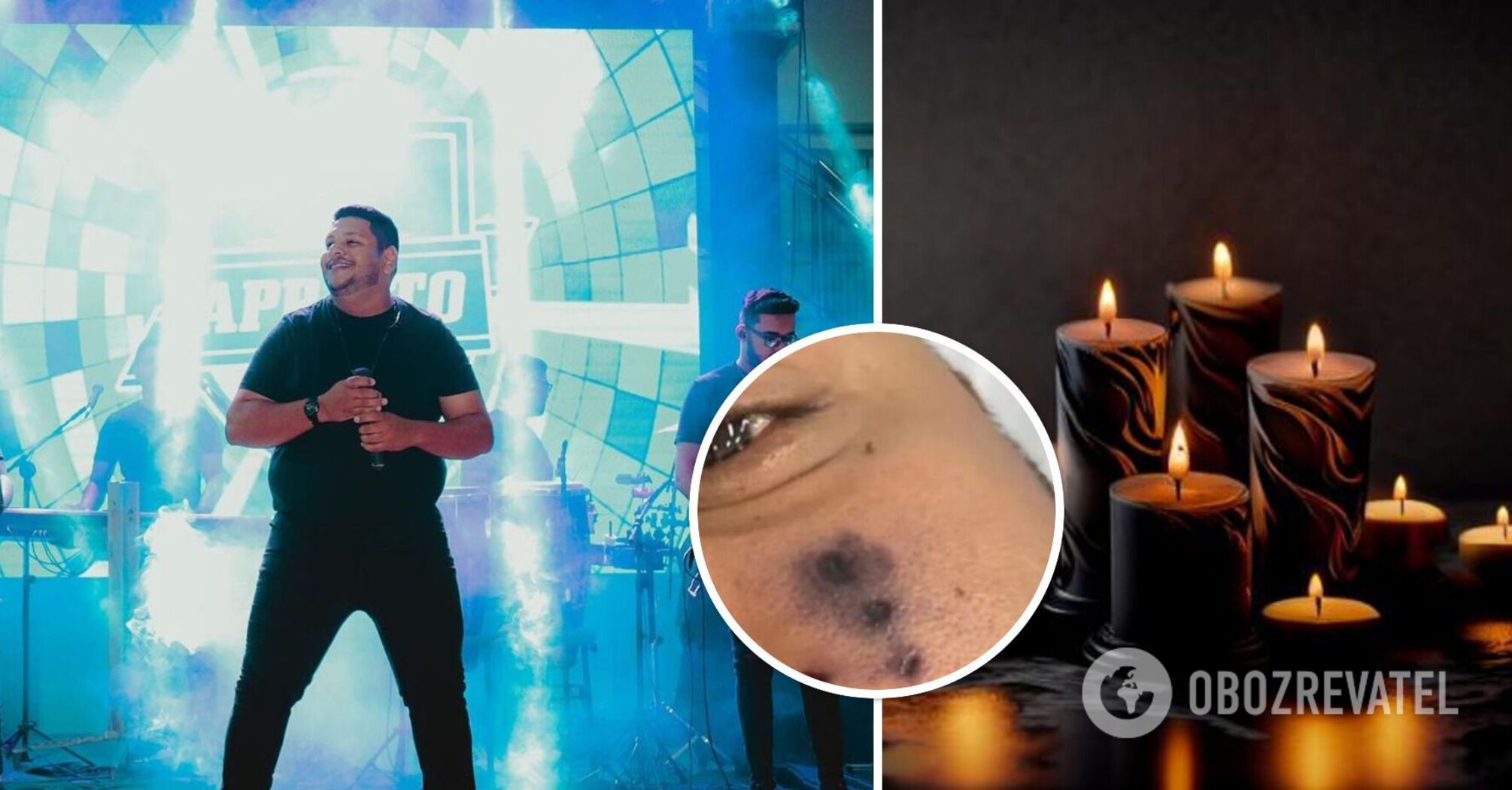 A 28-year-old singer died in Brazil: a spider bit him on the face. Photo