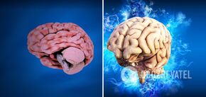 Co należy wiedzieć o stwardnieniu rozsianym: podstawowe objawy są nazywane