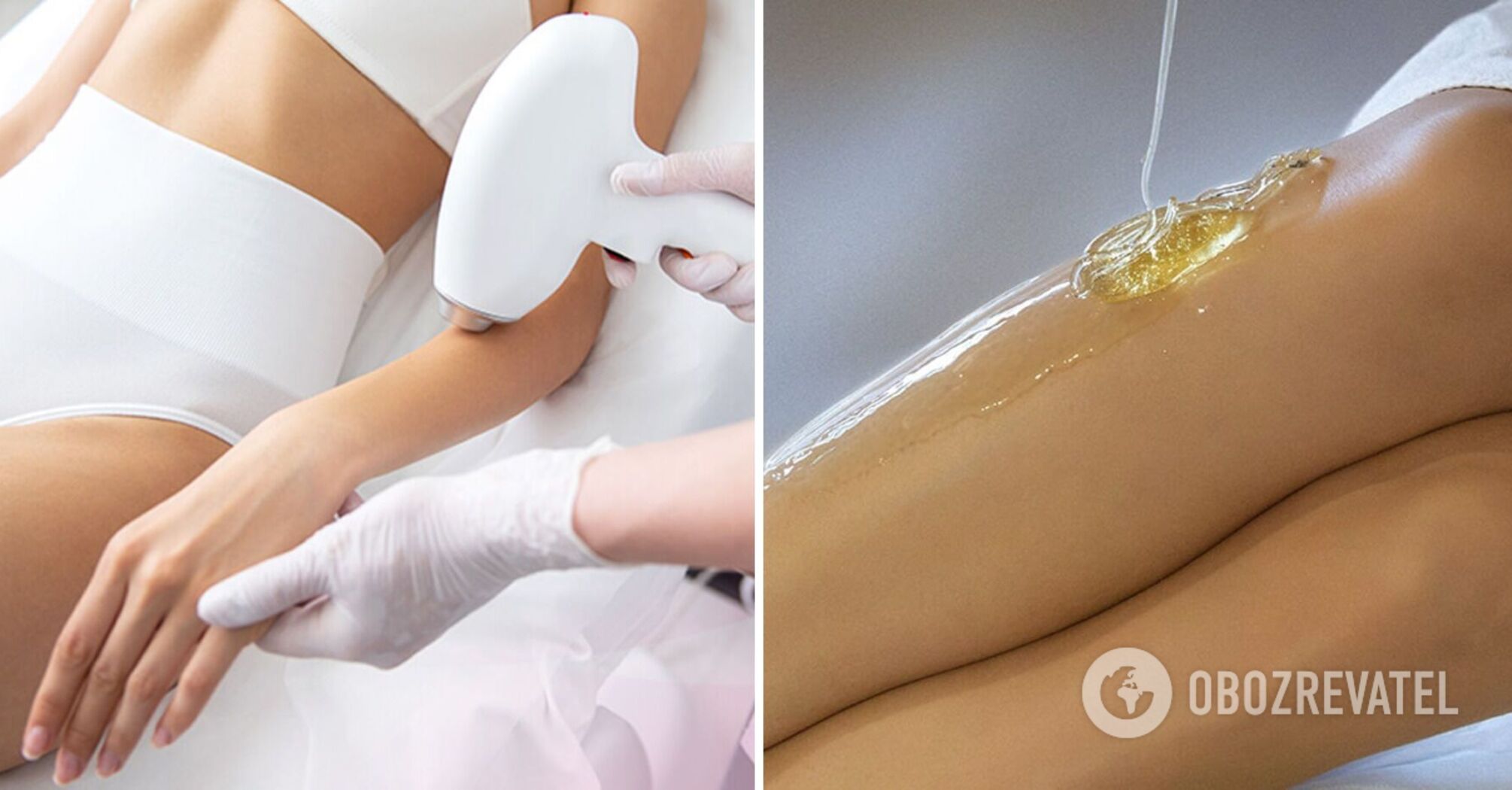 Why laser hair removal is more effective and safer than sugaring