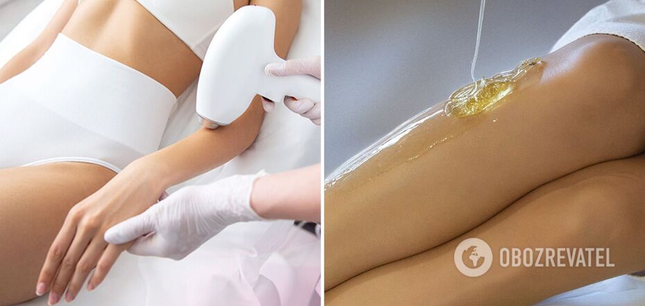 Why laser hair removal is more effective and safer than sugaring