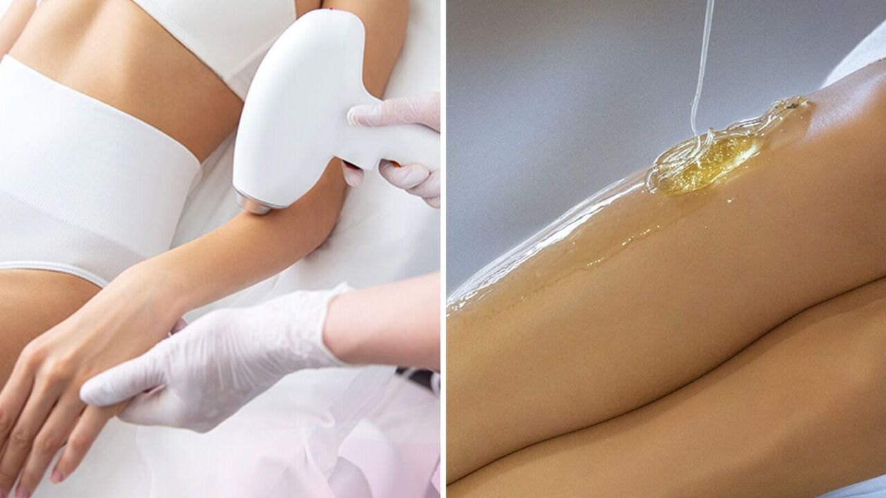 Dlaczego depilacja laserowa jest skuteczniejsza i bezpieczniejsza niż słodzenie?