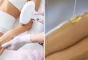 Dlaczego depilacja laserowa jest skuteczniejsza i bezpieczniejsza niż słodzenie?