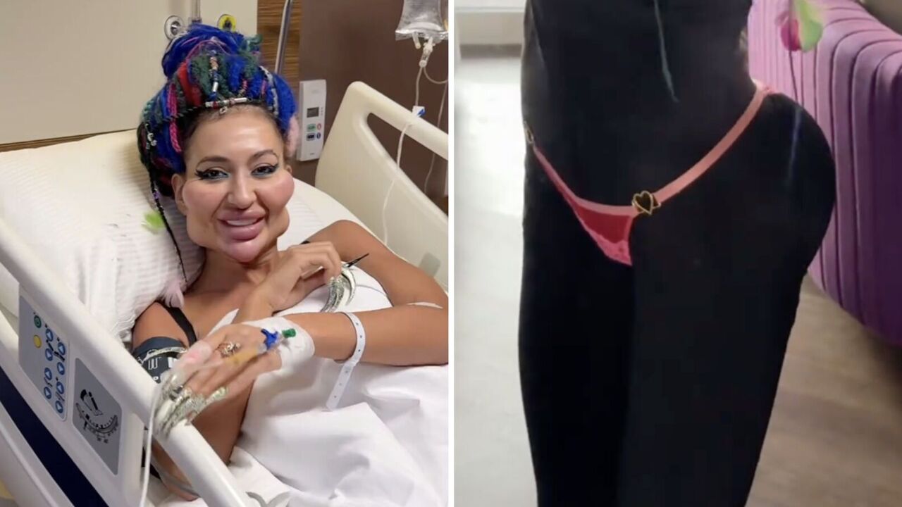 Almost like the Kardashians: the Ukrainian with the biggest cheekbones in the world has had her buttocks plastically enhanced. Photo
