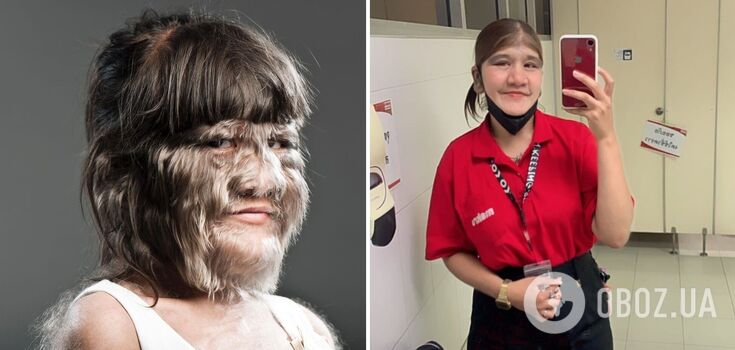 What the world's most hairy woman from the Guinness Book of Records looks like today: she got married and started shaving