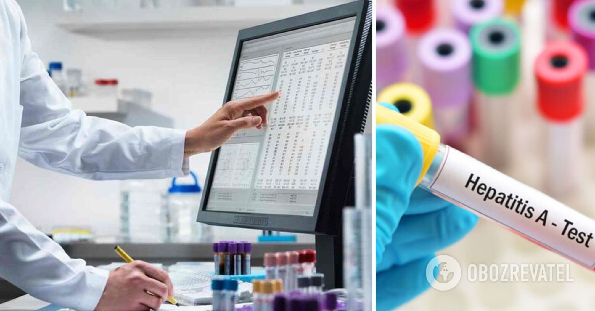 In the Vinnytsia region, the state of emergency due to the outbreak of Hepatitis A has been lifted: details