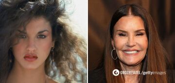Overdone: 5 celebrities who "aged" themselves with Botox. Photo