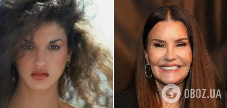 Overdone: 5 celebrities who "aged" themselves with Botox. Photo