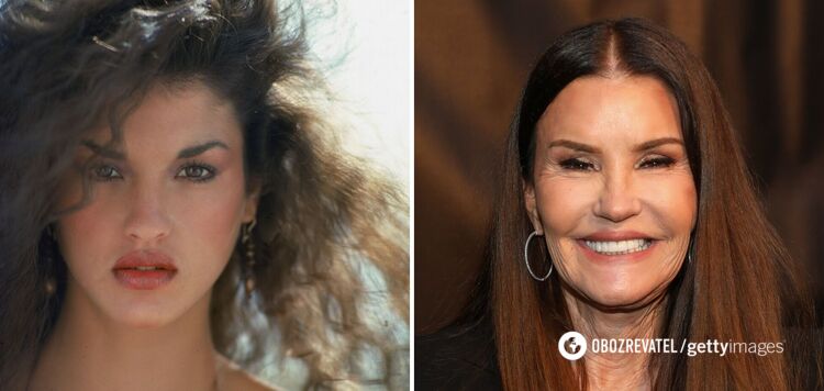 Overdone: 5 celebrities who 'aged' themselves with Botox. Photo