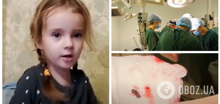 In Kherson, a girl miraculously survived after an enemy shell fragment hit her in the heart. Video