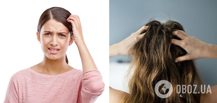 What will happen if you don't fight with lice in a person: shocking consequences shown in the video