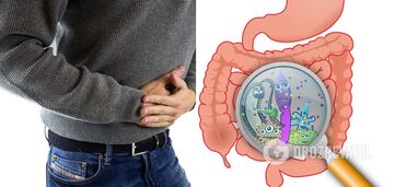 Irritable bowel syndrome: doctors told about early symptoms