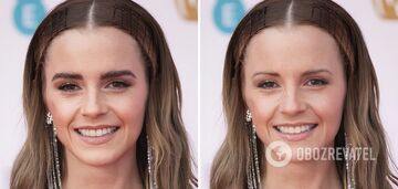 Unrecognizable: how some stars would look like without their 'features' in appearance. Photo