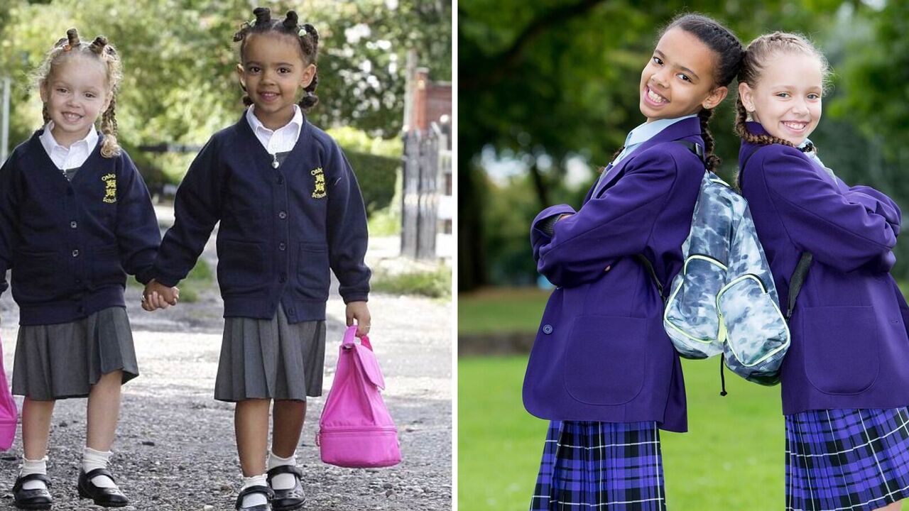 "One in a million": what happened to the twins of colour whose pictures have travelled the world
