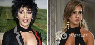 Pursuit of beauty cost lives: 5 stars who were killed by bad plastic surgery. Photo
