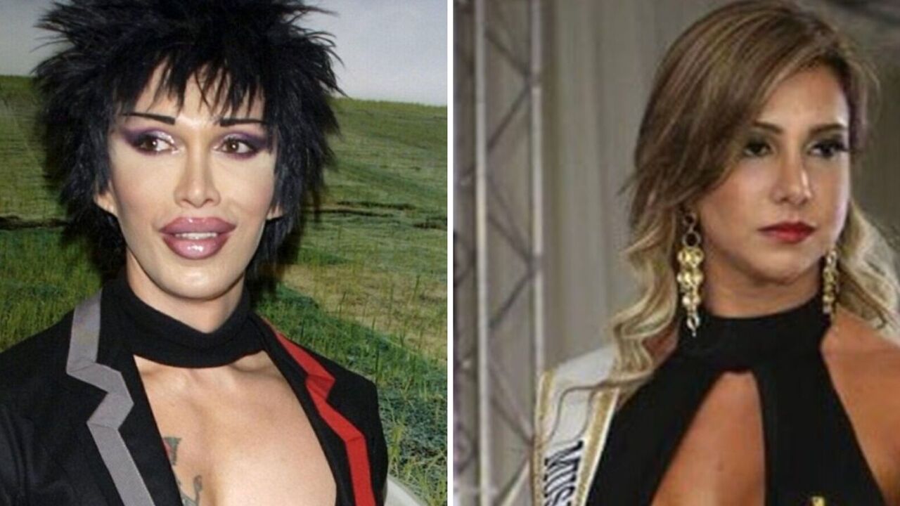 Pursuit of beauty cost lives: 5 stars who were killed by bad plastic surgery. Photo