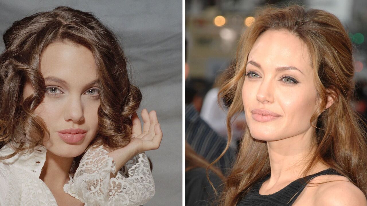 Megan Fox changed the shape of her nose, and Jolie changed the shape of her chest and cheekbones: 5 celebrities who had plastic surgery before the age of 30. Photos before and after